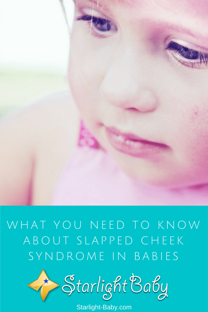 What You Need To Know About Slapped Cheek Syndrome In Babies