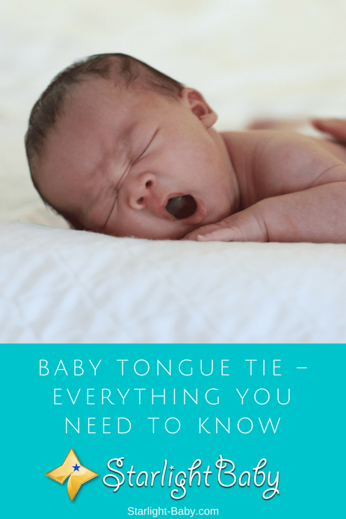 Baby Tongue Tie – Everything You Need To Know
