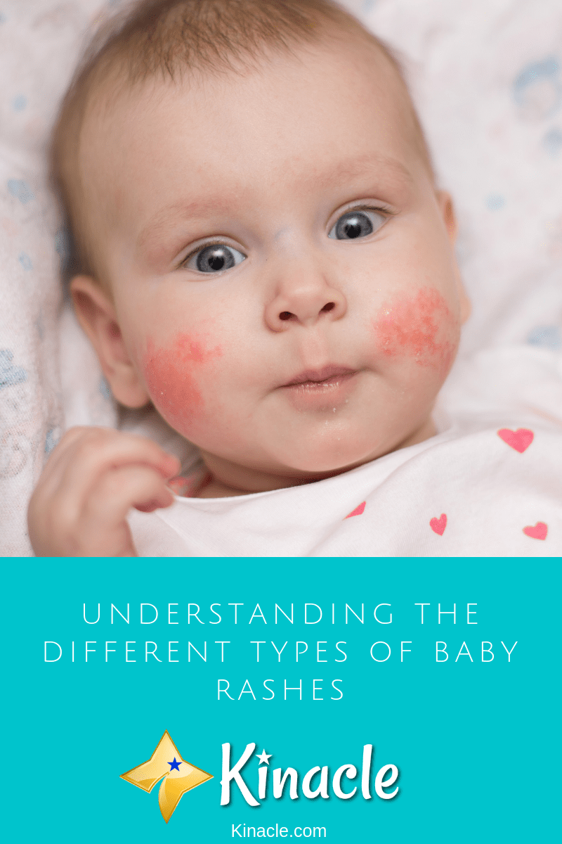 Understanding The Different Types Of Baby Rashes