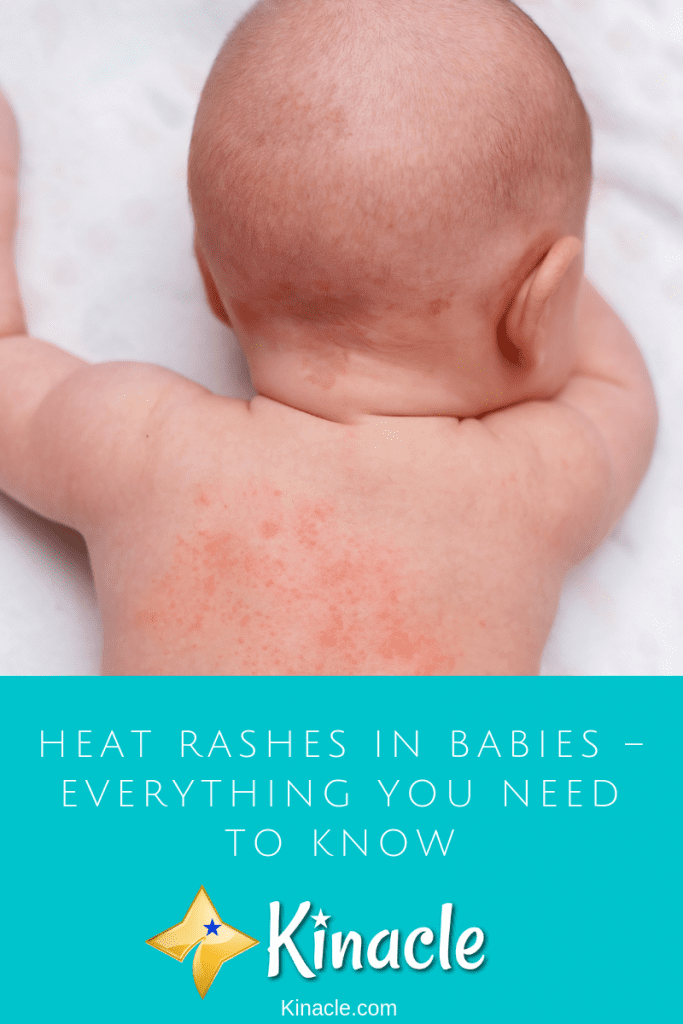 Heat Rashes In Babies – Everything You Need To Know