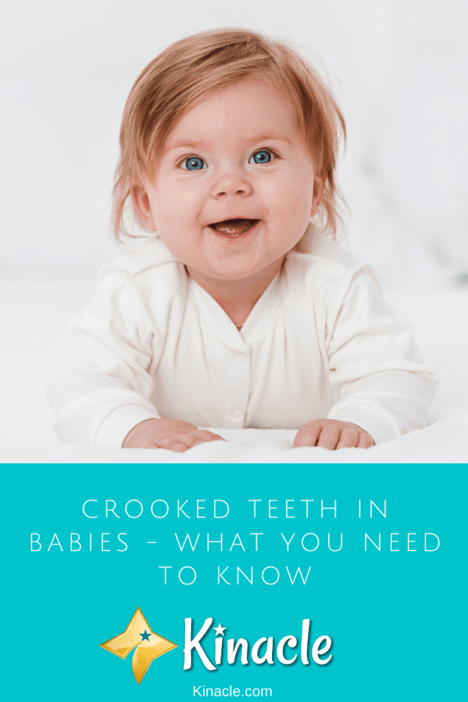Crooked Teeth In Babies - What You Need To Know